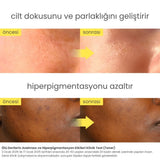 Niacindy Glow Reset Canlandırıcı & Cilt Tonu Eşitleyici Yüz Toniği - 250 mL
