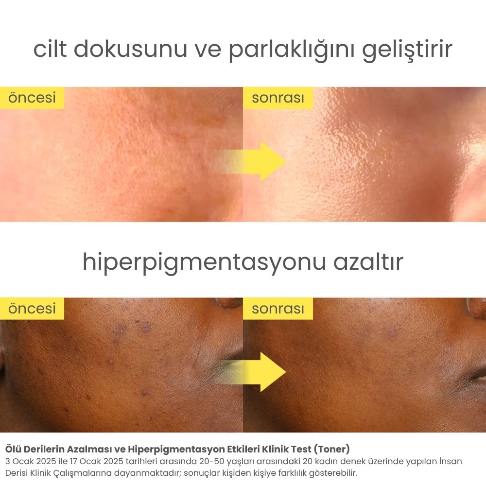 Niacindy Glow Reset Canlandırıcı & Cilt Tonu Eşitleyici Yüz Toniği - 250 mL