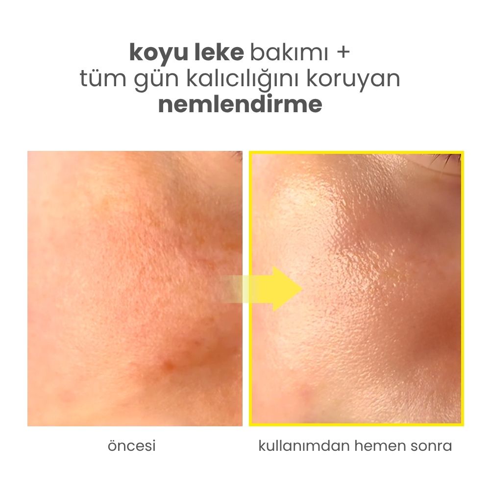 Niacindy Glow Reset Canlandırıcı & Cilt Tonu Eşitleyici Yüz Toniği - 250 mL