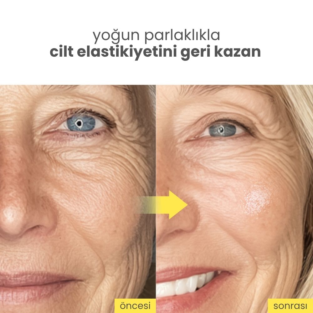 Niacindy Radiance Cilt Tonu Eşitleyici & Leke Karşıtı Aydınlatıcı Krem - 50 mL
