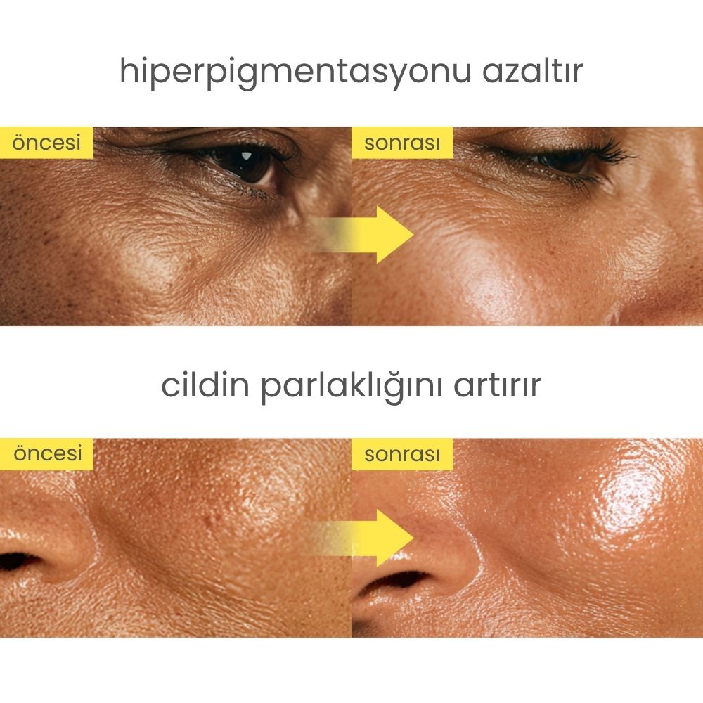 Niacindy Radiance Cilt Tonu Eşitleyici & Leke Karşıtı Aydınlatıcı Krem - 50 mL