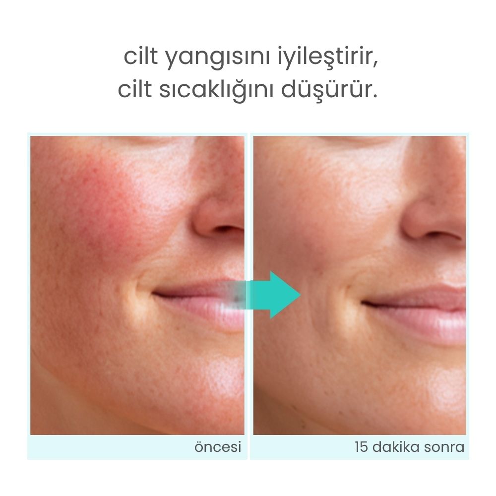 Icy Glacier Sherbet Kızarıklık Karşıtı & Nemlendirici Jel Krem - 100 mL