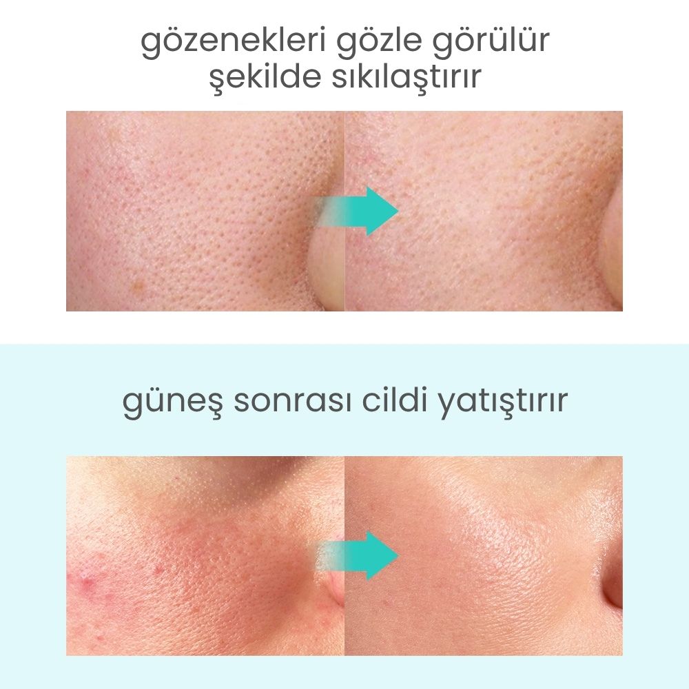 Icy Glacier Sherbet Kızarıklık Karşıtı & Nemlendirici Jel Krem - 100 mL