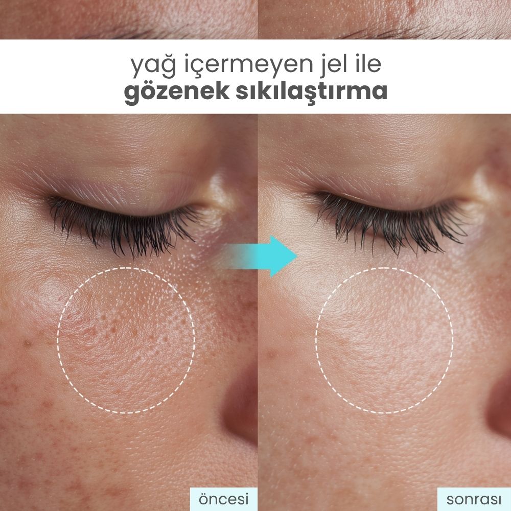gözenek sıklaştırıcı krem
