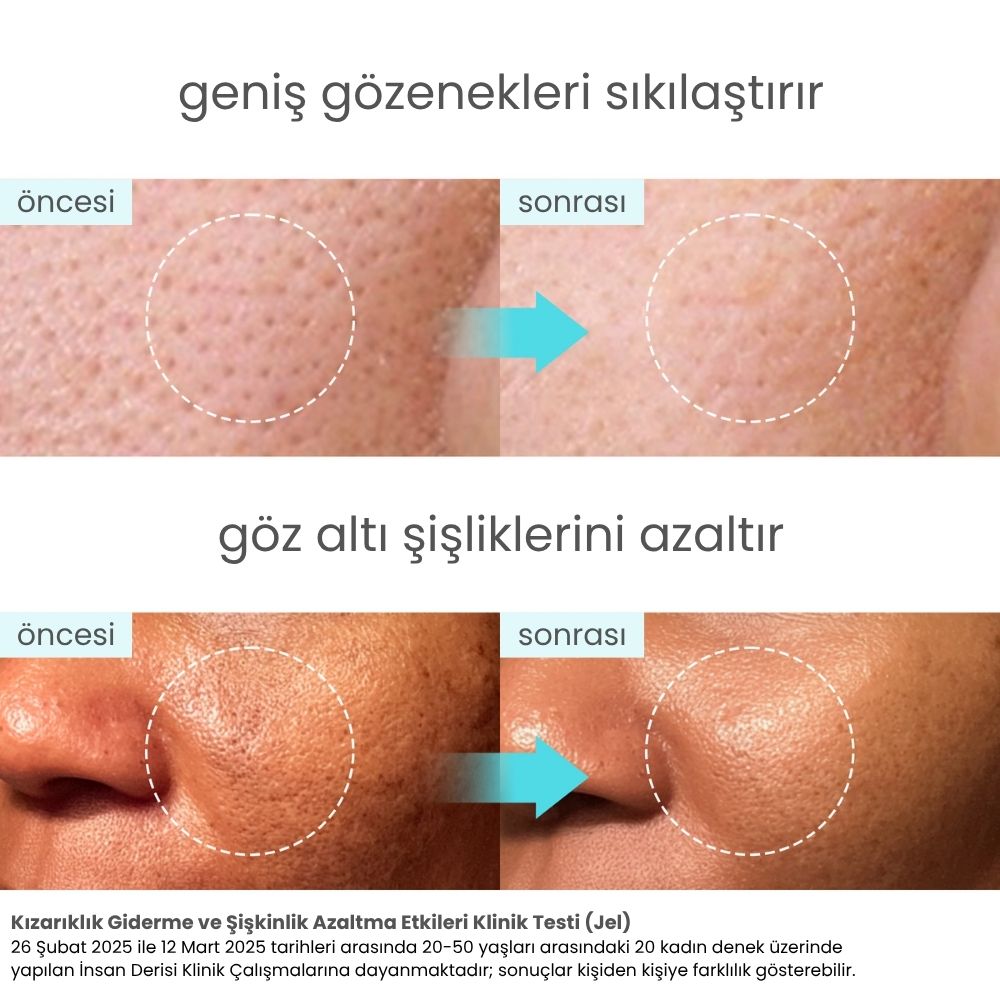 Icy Glacier Sherbet Kızarıklık Karşıtı & Nemlendirici Jel Krem - 100 mL