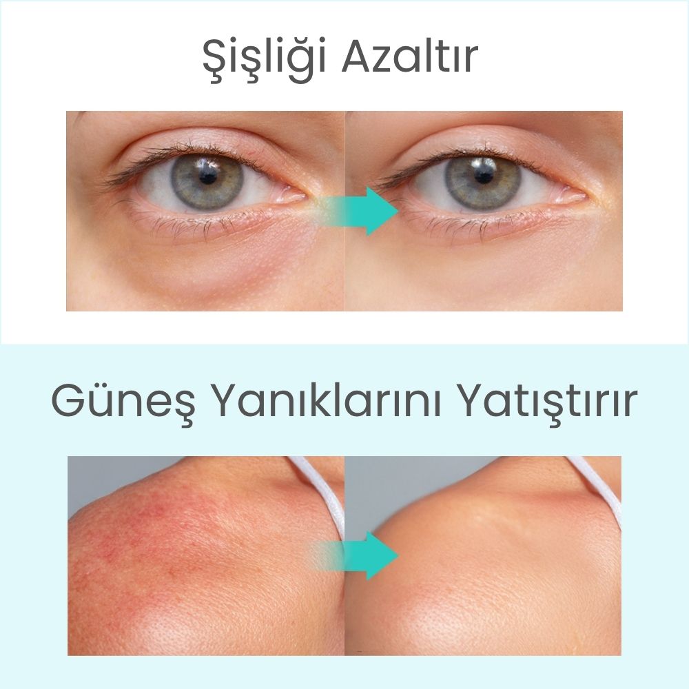 Icy Glacier Sherbet Serinletici Kızarıklık Karşıtı & Gözenek Sıkılaştırıcı Tonik Ped - 220 mL