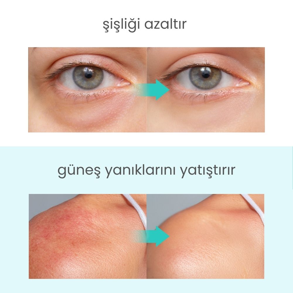 Icy Glacier Sherbet Serinletici Kızarıklık Karşıtı & Gözenek Sıkılaştırıcı Tonik Ped - 220 mL