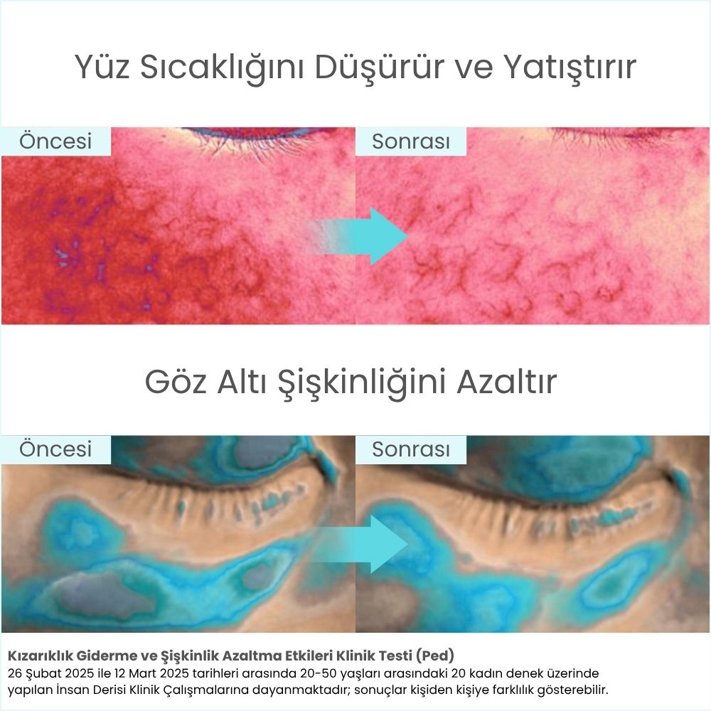 Icy Glacier Sherbet Serinletici Kızarıklık Karşıtı & Gözenek Sıkılaştırıcı Tonik Ped - 220 mL