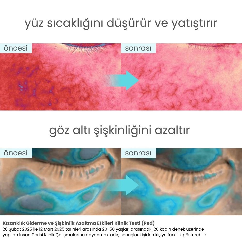 Icy Glacier Sherbet Serinletici Kızarıklık Karşıtı & Gözenek Sıkılaştırıcı Tonik Ped - 220 mL